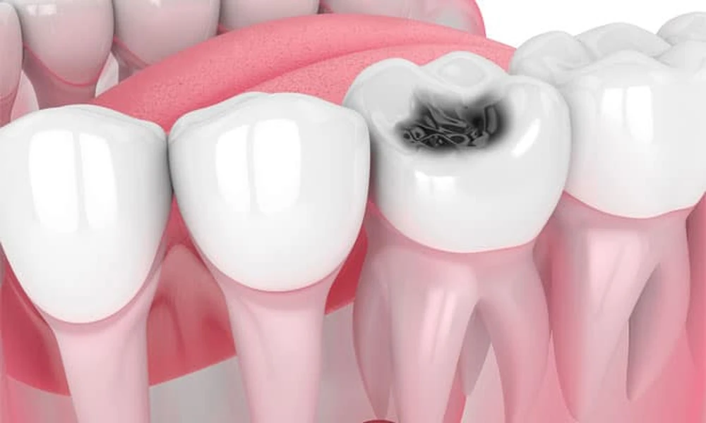 5 Signs You’re Ready To Add Cosmetic Dentistry To Your Family Care Plan